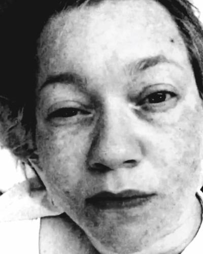 Mia Maja Holst Manstrup, selfie før indlæggelse, til artiklen 'Mia Maja fik en fødselspsykose. Men det var psykiatrien, der knækkede hende'