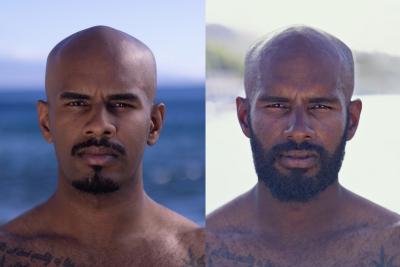 Zax Thiyakarajah før og efter