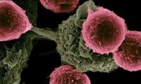 Nyt fra forskningen, celler i behandling, skanning af National Cancer Institute
